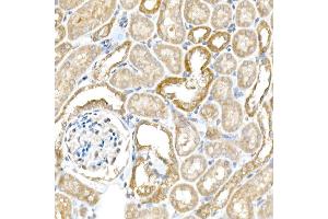 Immunohistochemistry of paraffin-embedded mouse kidney using B Rabbit pAb (ABIN6129977, ABIN6137413, ABIN6137415 and ABIN6220894) at dilution of 1:25 (40x lens). (BACE1 Antikörper  (AA 22-322))