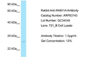 Western Blotting (WB) image for anti-RAB11A, Member RAS Oncogene Family (RAB11A) (C-Term) antibody (ABIN2774380) (RAB11A Antikörper  (C-Term))