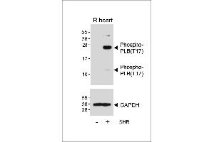 Western blot analysis of lysates from Rat heart tissue and spontaneous hypertensive (SHR) rat heart tissue lysate, using Phospho-PLB(T17) Antibody (ABIN650834 and ABIN2839801) (upper) or GDH (lower). (Phospholamban Antikörper  (pThr17))