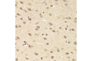 Immunohistochemistry of paraffin-embedded mouse brain using JMJD6 antibody at dilution of 1:200 (400x lens).