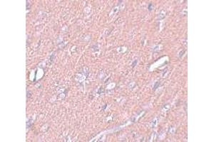 Immunohistochemistry (IHC) image for anti-Synaptogyrin 3 (SYNGR3) (C-Term) antibody (ABIN1030716) (Synaptogyrin 3 Antikörper  (C-Term))