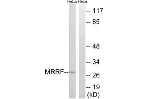 Western blot analysis of extracts from HeLa cells, using MRRF antibody. (MRRF Antikörper  (C-Term))