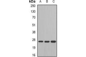 Western blot analysis of GSTM4 expression in SW480 (A), mouse liver (B), mouse lung (C) whole cell lysates.