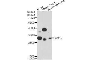 Western blot analysis of extracts of various cell lines, using VAPA Antibody (ABIN6293738) at 1:3000 dilution.