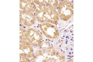 (ABIN6243533 and ABIN6578631) staining IP in human kidney tissue sections by Immunohistochemistry (IHC-P - paraformaldehyde-fixed, paraffin-embedded sections). (APIP Antikörper  (AA 111-142))