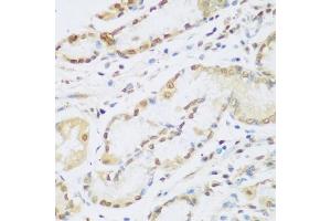 Immunohistochemistry of paraffin-embedded human stomach using CCND2 antibody (ABIN1875413) at dilution of 1:100 (40x lens). (Cyclin D2 Antikörper)