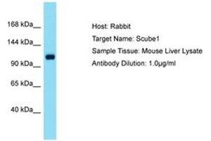 Image no. 1 for anti-Signal Peptide, CUB Domain, EGF-Like 1 (SCUBE1) (AA 518-567) antibody (ABIN6750516) (SCUBE1 Antikörper  (AA 518-567))