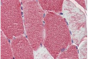 Human Skeletal Muscle: Formalin-Fixed, Paraffin-Embedded (FFPE) (POLG Antikörper  (AA 829-1201))
