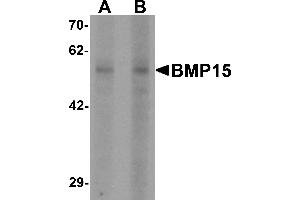 Western blot analysis of BMP15 in 3T3 cell lysate with BMP15 antibody at (A) 1 and (B) 2 µg/mL (BMP15 Antikörper  (N-Term))