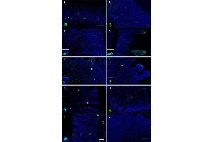 Visualization of OR51E1 tissue distribution in the gastrointestinal tract.