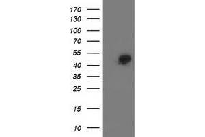 Western Blotting (WB) image for anti-Spermine Synthase, SMS (SMS) antibody (ABIN1501094) (SMS Antikörper)
