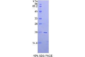 SDS-PAGE analysis of Rat a2PI Protein.