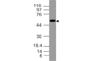 Image no. 1 for anti-Aldehyde Dehydrogenase 1 Family, Member A1 (ALDH1A1) (AA 284-492) antibody (ABIN5027017) (ALDH1A1 Antikörper  (AA 284-492))