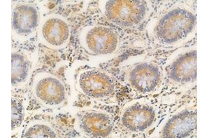 ABIN6263556 and ABIN6266729 at 1/100 staining human normal colon tissue by IHC-P.