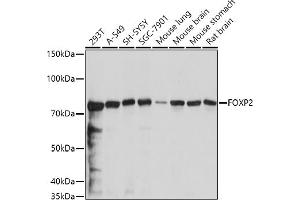 Western blot analysis of extracts of various cell lines, using FOXP2 antibody (ABIN6127914, ABIN6140762, ABIN6140763 and ABIN6221330) at 1:1000 dilution. (FOXP2 Antikörper  (AA 441-740))