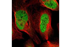 Immunofluorescent staining of U-2 OS with ARID1A polyclonal antibody  (Green) shows positivity in nucleus but excluded from the nucleoli.