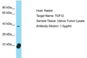 Host: Rabbit Target Name: TCF4 Sample Tissue: Human Uterus Tumor Antibody Dilution: 1ug/ml (TCF12 Antikörper  (C-Term))