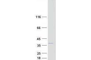 ZCRB1 Protein (Myc-DYKDDDDK Tag)
