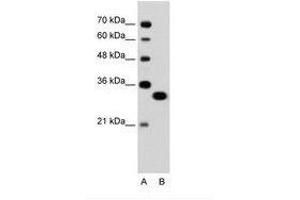 Image no. 1 for anti-Transcription Factor EC (TFEC) (AA 71-120) antibody (ABIN6736324) (TFEC Antikörper  (AA 71-120))