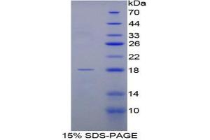 SDS-PAGE analysis of Rat FABP1 Protein. (FABP1 Protein)