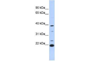 PEF1 antibody used at 1 ug/ml to detect target protein.