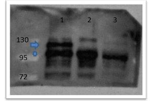 Western Blot of Rabbit anti-catenin ß-1 antibody Lane 1: zebrafish embryos injected with myc tagged catenin ß 1 mRNA Lane 2: zebrafish embryos injected with myc tagged catenin ß 2 mRNA Lane 3: zebrafish embryos un-injected Primary antibody: catenin ß-1 antibody at 1:500 overnight at 4°C Secondary antibody: goat anti-rabbit HRP at 1:10,000 for 1 hour at RT Predicted/Observed size: 85.