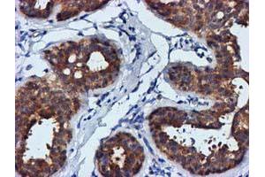 Immunohistochemical staining of paraffin-embedded Human breast tissue using anti-FGFR2 mouse monoclonal antibody. (FGFR2 Antikörper)