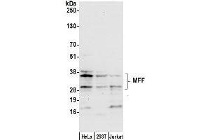 anti-Mitochondrial Fission Factor (MFF) (AA 100-150) antibody