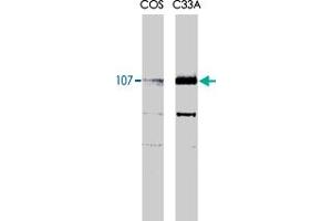 Rbl1 monoclonal antibody, clone KAB6  recognizes both the phosphorylated and unphosphorylated forms of p107 at 107kDa. (p107 Antikörper)