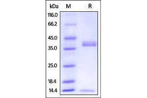 SDS-PAGE (SDS) image for neonatal Fc Receptor (FcRn) (AA 24-297) (Active) protein (His tag,AVI tag,Strep Tag,Biotin) (ABIN2870526)