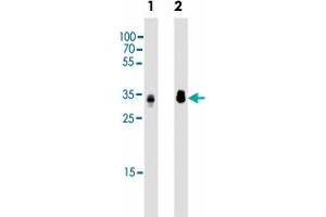 Western blot analysis of Lane 1: Hela whole cell lysates Lane 2: HepG2 whole cell lysates reacted with PPT1 monoclonal antibody  at 1:2000 dilution.