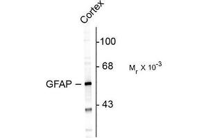 Image no. 1 for anti-Glial Fibrillary Acidic Protein (GFAP) antibody (ABIN372651) (GFAP Antikörper)