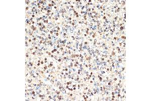 Immunohistochemistry of paraffin-embedded human spleen using SHIP11 Rabbit mAb (ABIN7267882) at dilution of 1:100 (40x lens). (INPP5D Antikörper)