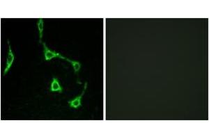 Immunofluorescence analysis of LOVO cells, using CDH10 Antibody.