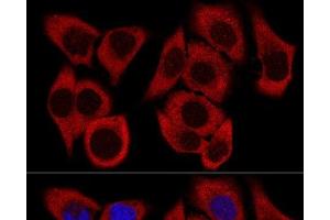Confocal immunofluorescence analysis of HeLa cells using RPL36 Polyclonal Antibody at dilution of 1:200. (RPL36 Antikörper)