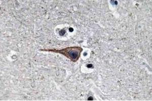 Immunohistochemistry (IHC) analysis of EGF antibody in paraffin-embedded human brain tissue. (EGF Antikörper)