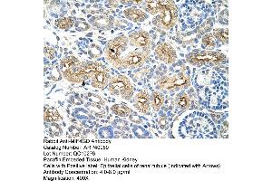 Rabbit Anti-MIF4GD Antibody  Paraffin Embedded Tissue: Human Kidney Cellular Data: Epithelial cells of renal tubule Antibody Concentration: 4. (MIF4GD Antikörper  (C-Term))