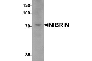 Western blot analysis of NIBRIN in mouse lung tissue lysate with NIBRIN antibody at 1 µg/mL. (Nibrin Antikörper  (C-Term))
