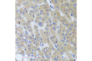 Immunohistochemistry of paraffin-embedded human liver injury using SYNPO antibody at dilution of 1:100 (x40 lens).