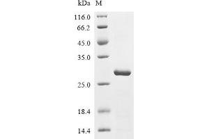 (Tris-Glycine gel) Discontinuous SDS-PAGE (reduced) with 5 % enrichment gel and 15 % separation gel.