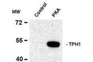 Image no. 1 for anti-Tryptophan Hydroxylase 1 (TPH1) (pSer58) antibody (ABIN372732) (Tryptophan Hydroxylase 1 Antikörper  (pSer58))