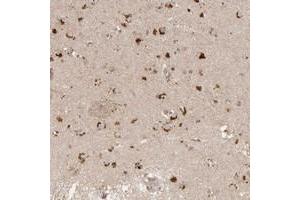Immunohistochemical staining of human lateral ventricle with FAM211A polyclonal antibody  shows strong cytoplasmic positivity in neuronal cells at 1:20-1:50 dilution. (LRRC75A/FAM211A Antikörper)