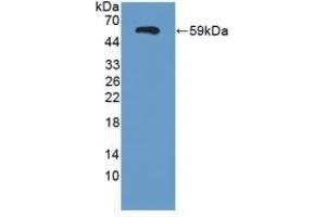 Detection of Recombinant SEMA3E, Human using Polyclonal Antibody to Semaphorin 3E (SEMA3E) (SEMA3E Antikörper  (AA 32-516))