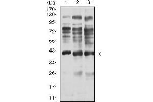 Western Blotting (WB) image for anti-ArfGAP with Dual PH Domains 1 (ADAP1) (AA 240-370) antibody (ABIN5611219)
