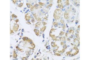 Immunohistochemistry of paraffin-embedded Human stomach using PRKAG1 Polyclonal Antibody at dilution of 1:100 (40x lens). (PRKAG1 Antikörper)