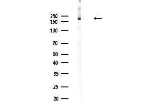 Western blot analysis of lysates from PC12 cells(heat-shock,45 min treatment), using Clathrin Antibody at 1/1000 dilution.