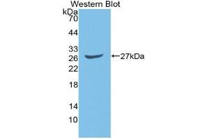 Western blot analysis of the recombinant protein. (GATA2 Antikörper  (AA 117-338))
