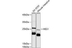 Western blot analysis of extracts of various cell lines, using HES1 antibody (ABIN6129271, ABIN6141726, ABIN6141728 and ABIN6215415) at 1:1000 dilution. (HES1 Antikörper  (AA 151-280))