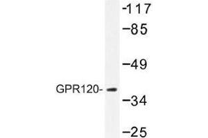 Image no. 1 for anti-omega-3 Fatty Acid Receptor 1 (O3FAR1) antibody (ABIN317737) (O3FAR1 Antikörper)