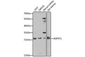 Western blot analysis of extracts of various cell lines, using AGPAT1 antibody. (AGPAT1 Antikörper  (AA 204-283))